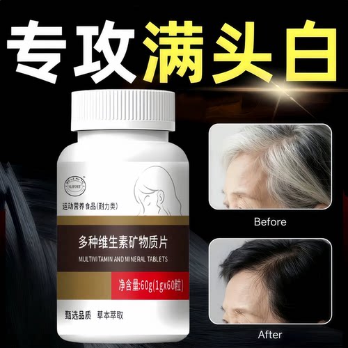西夫康维生素B乌发片防白发