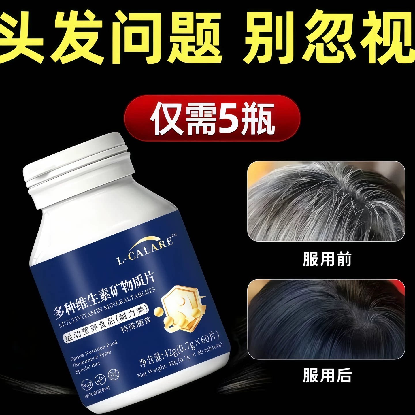 必克邦维生素B片乌发固发