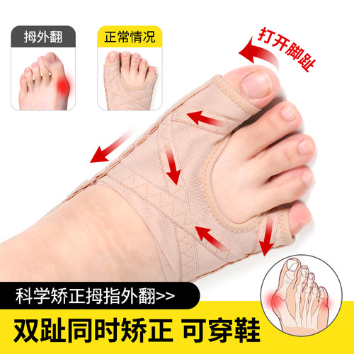 拇外翻小趾内翻可调分趾矫正器