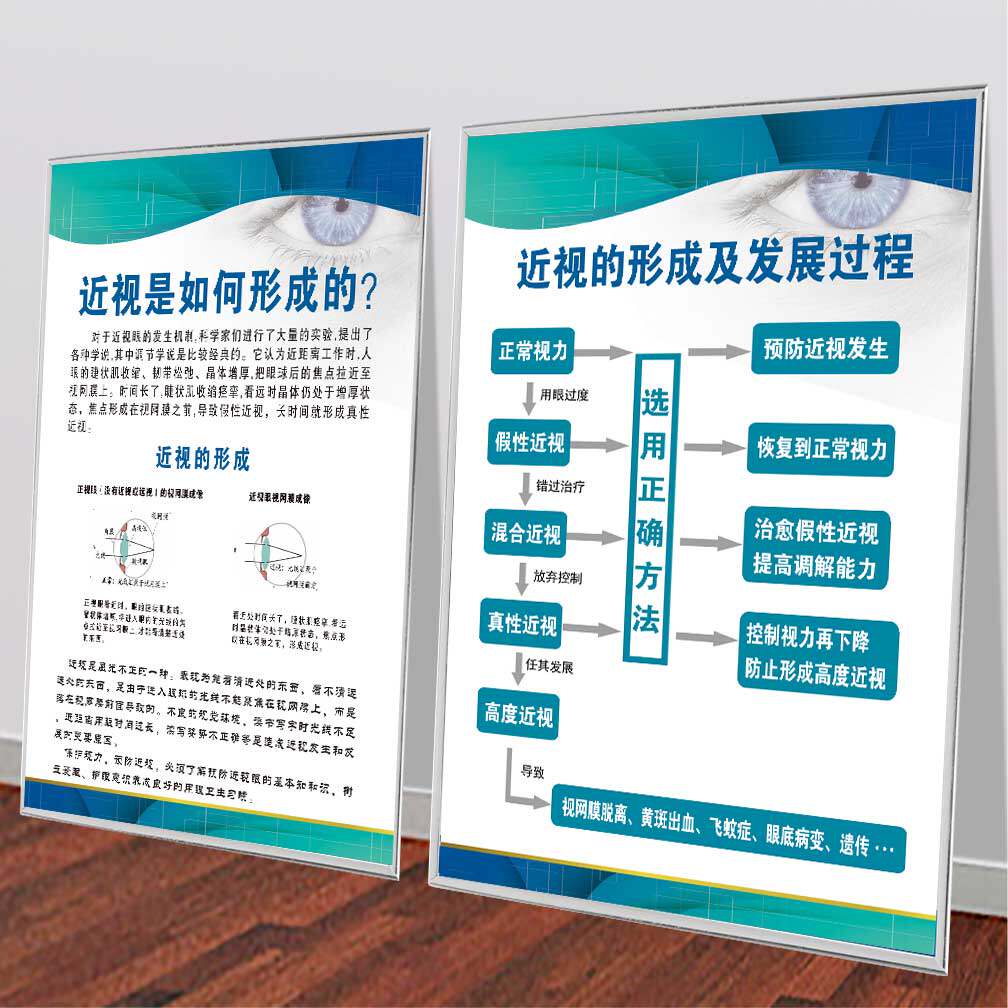 眼肌运动训练图宣传海报高清覆膜