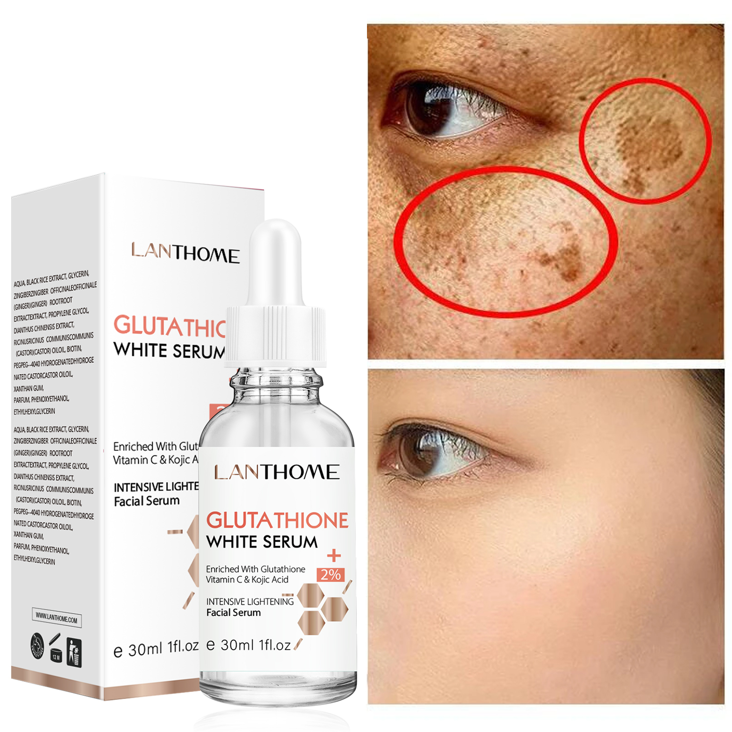 30ML Glutathione Whitening Freckles Serum Remove Dark Spots