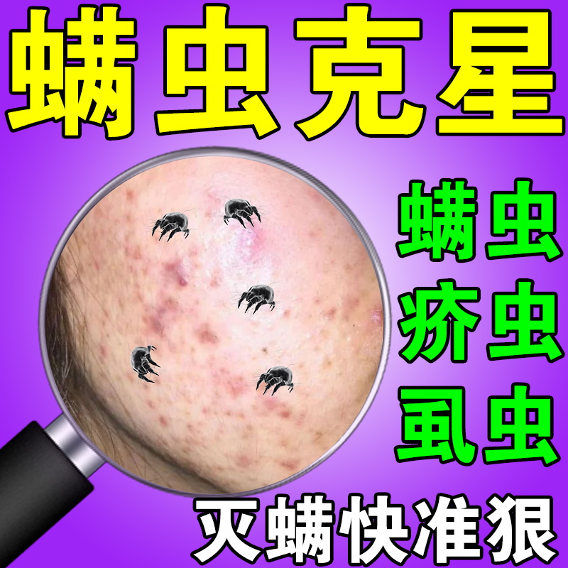 螨虫专用药膏人用叮咬脸上螨虫除螨祛痘背上长痘痘后背药膏淡化印