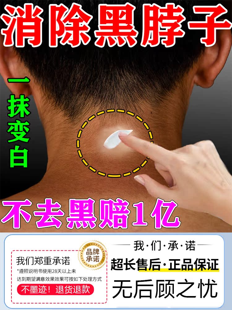 脖子黑黑的黑棘皮症去除脖子黑色素沉淀肥胖儿童皮肤美白神器药膏