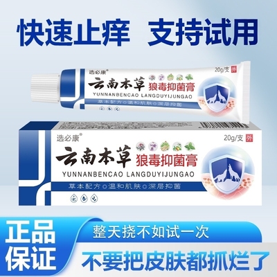 牛皮癣湿疹皮炎皮肤瘙痒全身可用