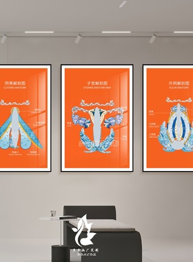 橙色轻奢私密解剖图装饰画月子中心美容院背景墙子宫骨盆结构挂画