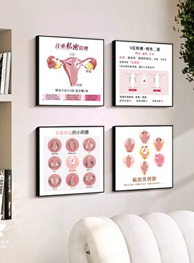 私密管理装饰画女性阴道自测程度图挂画妇产科产后修复宣传墙壁画