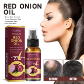 Strengthening Onion Thickening Smoothing Hair Oil