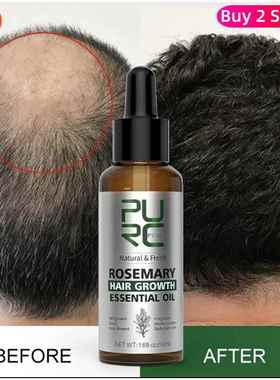 Rosemary Oil Hair Growth Products Ginger Anti Loss Fast