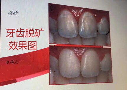 老客户一次全口牙的量回购专用链接