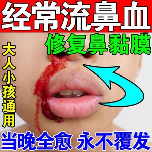 流鼻血专用药治疗儿童小孩鼻腔干燥结痂鼻出血修复鼻粘膜止血神器