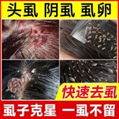 除骚子药灭虱子跳蚤药小孩头上长虱子药女孩头发上有狮子药水儿童