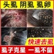 除骚子药灭虱子跳蚤药小孩头上长虱子药女孩头发上有狮子药水儿童
