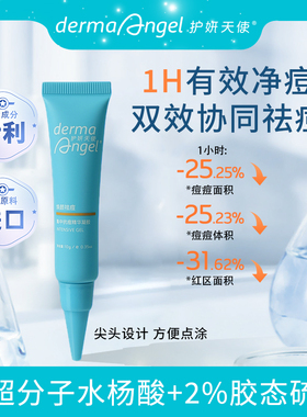 护妍天使祛痘凝胶控油抗痘去角质水杨酸凝胶精华祛痘膏10ml
