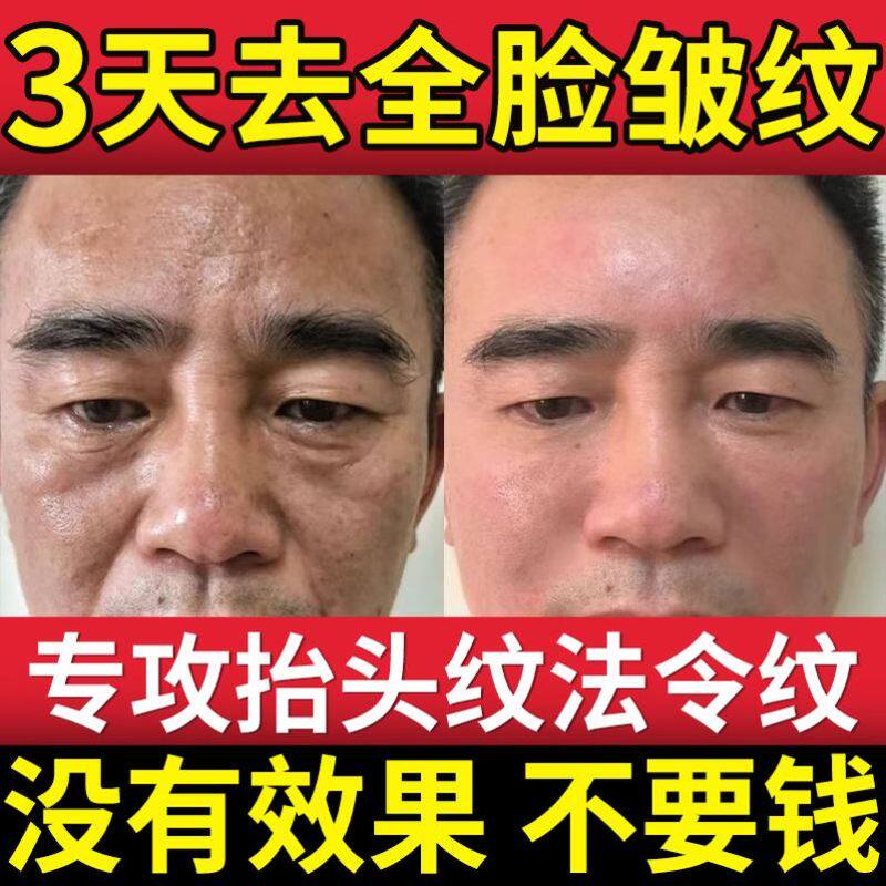 男士面霜紧致抗皱抗衰老淡化细纹抬头纹消除神器去除专用额头提拉
