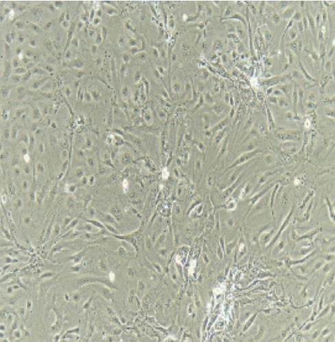 载脂蛋白B100(APOB100)重组蛋白  科研用品