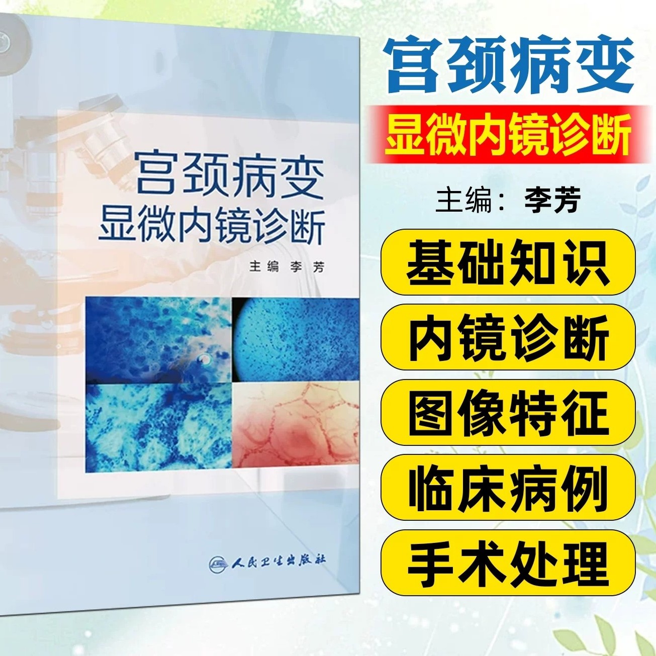 宫颈病变显微内镜诊断李芳
