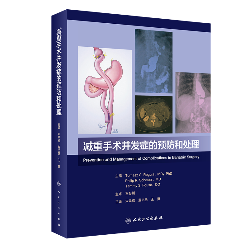 减重手术并发症的预防和处理
