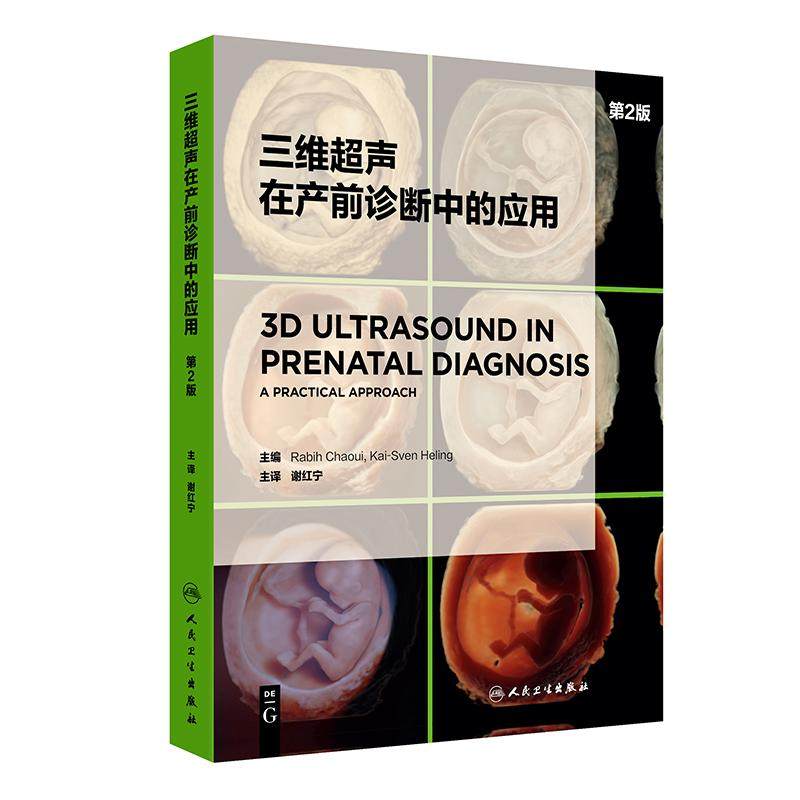 三维超声在产前诊断中的应用