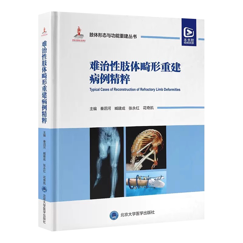 难治性肢体畸形重建病例精粹