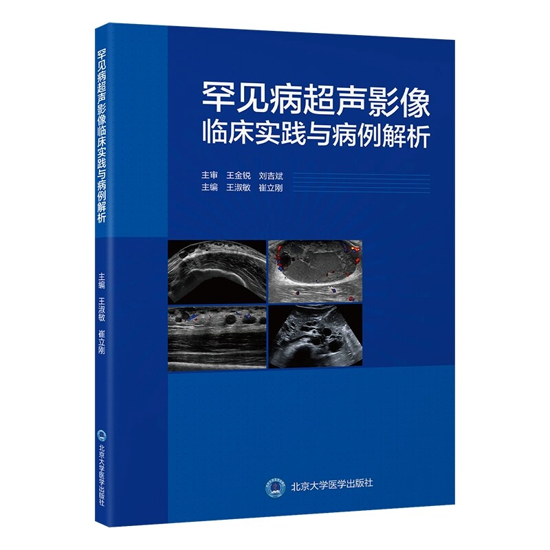 罕见病超声影像临床实践与病例解析 王淑敏 崔立刚 主编 精选具有超声异常表现的罕见病 北京大学医学出版社 9787565932694