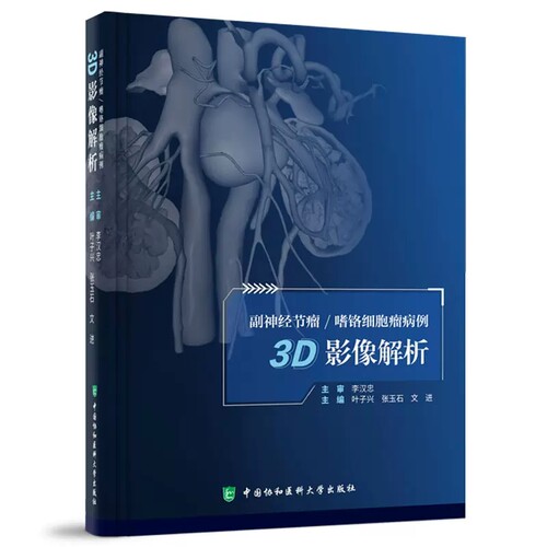 副神经节瘤嗜铬细胞瘤病例3D影