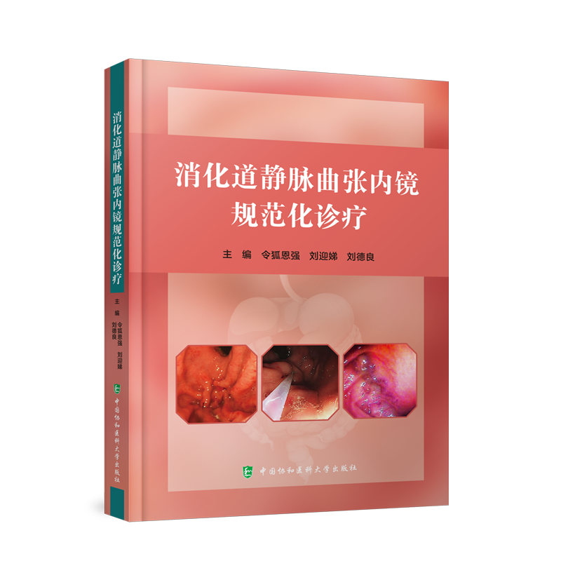 消化道静脉曲张内镜规范化诊疗