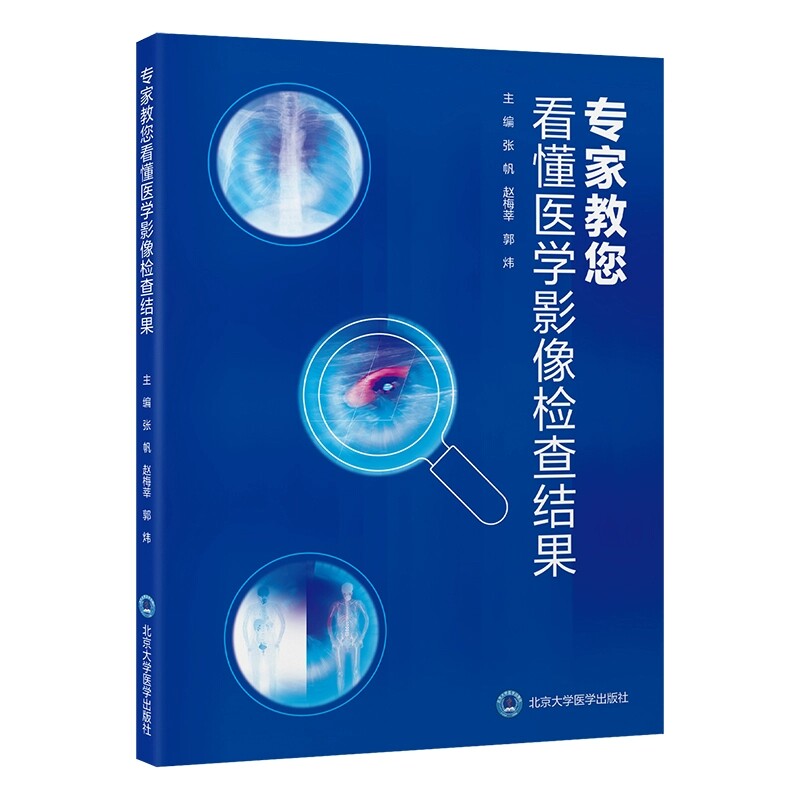 家教您看懂医学影像检查结果