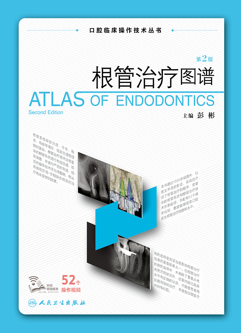 根管治疗图谱第2版口腔临床