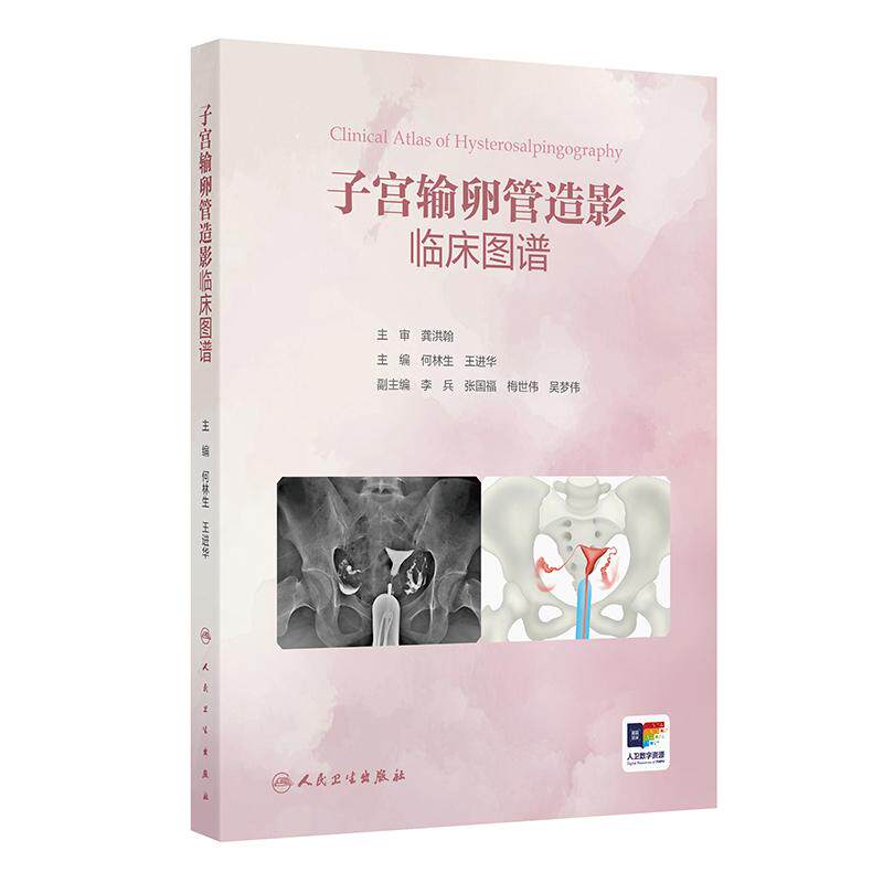 子宫输卵管造影临床图谱
