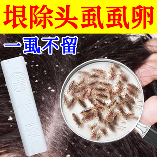 神奇药笔去头虱子药儿童虱子药头发虱立净去除虱卵百部酊灭头虱cq