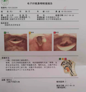 声带囊肿物息接触性肉芽肿肥厚小结咽干喉咙疼痛异物感声音嘶哑炎