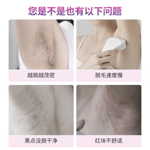 脱毛膏川井岩不留光滑腿部毛发黑干净去除涂抹膏细腻弘腋下手臂