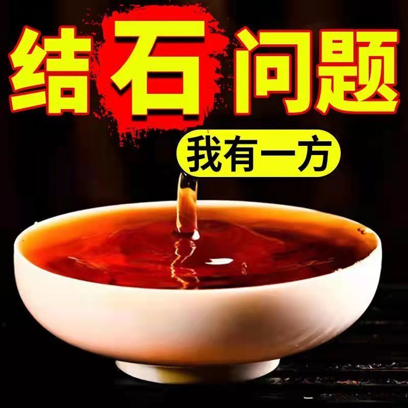 胆肾结石溶石化石排石结石贴
