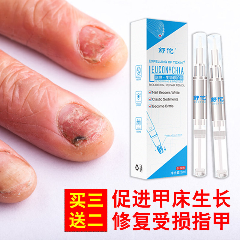 甲床修复液价格 甲床修复液图片 星期三