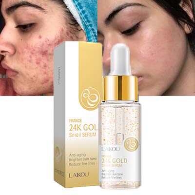Snail Repairing Serum Anti-Acne Essence Scars蜗牛面部精华液