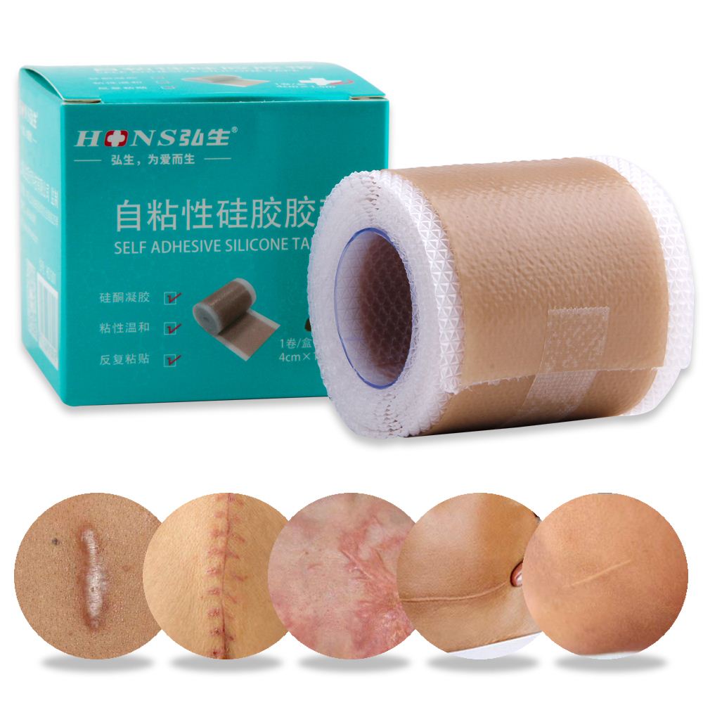 4x50cm Silicone Scars Patch Wounds Band Remove Acne Burn Sca