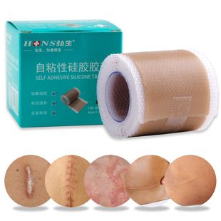 4x50cm Silicone Scars Patch Wounds Band Remove Acne Burn Sca