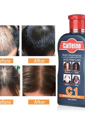 Caffeine Shampoo Slow Down Hair Loss Stimulate Hair Growth