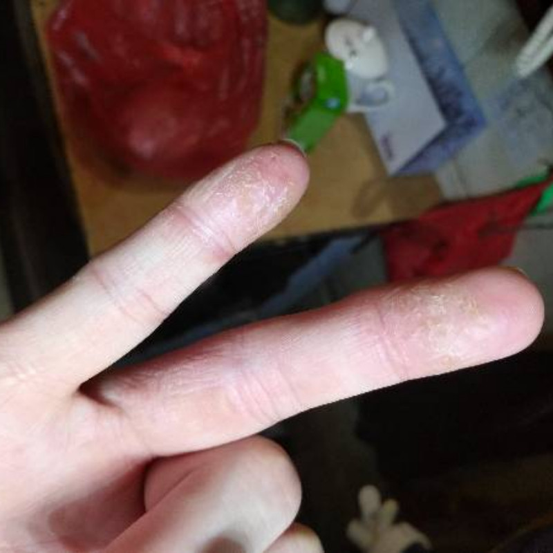 手指头裂口子干裂修复护手霜开裂脱皮手足手脚冬季皲裂膏保湿手裂