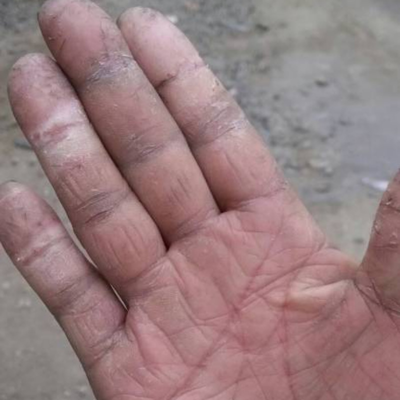 手指头裂口子干裂修复护手霜开裂脱皮裂开手足开口手脚冬季皲裂膏