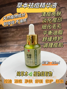 草本祛痘精华液去粉刺闭口痘痘痘印痘疤收缩毛孔修护肌肤控油男女