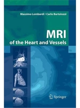 预订不退不换MRI of the Heart and Vessels