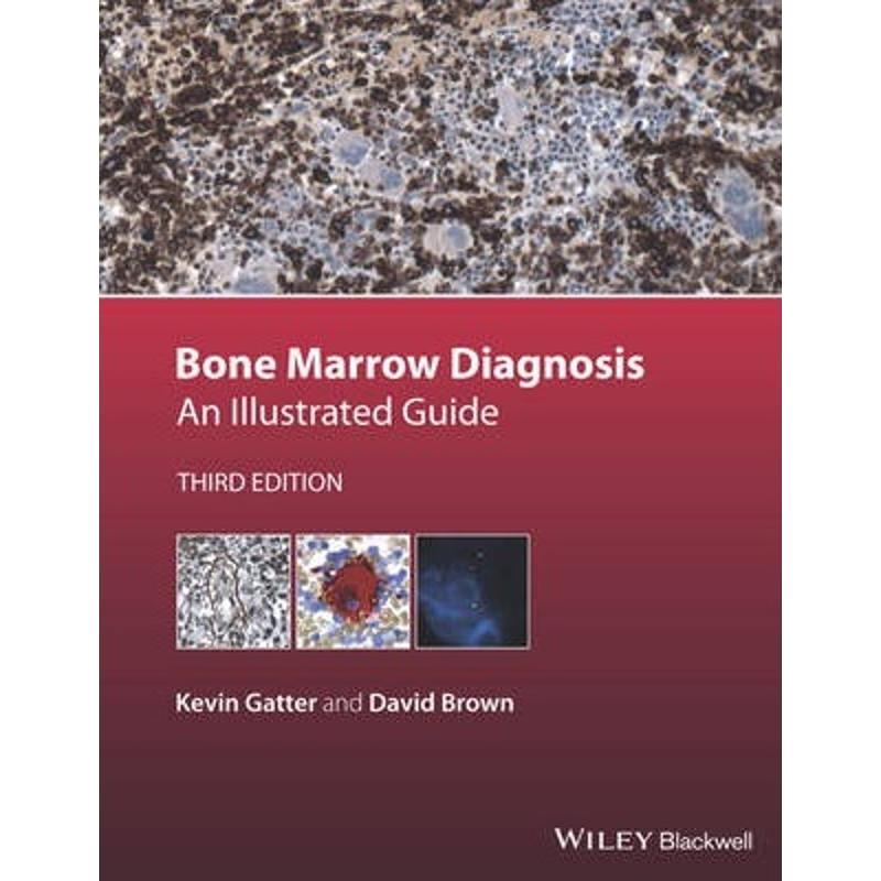 预订bone marrow diagnosis:an illustrated guide