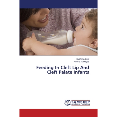 按需印刷Feeding In Cleft Lip And Cleft Palate Infants[9783659382123]