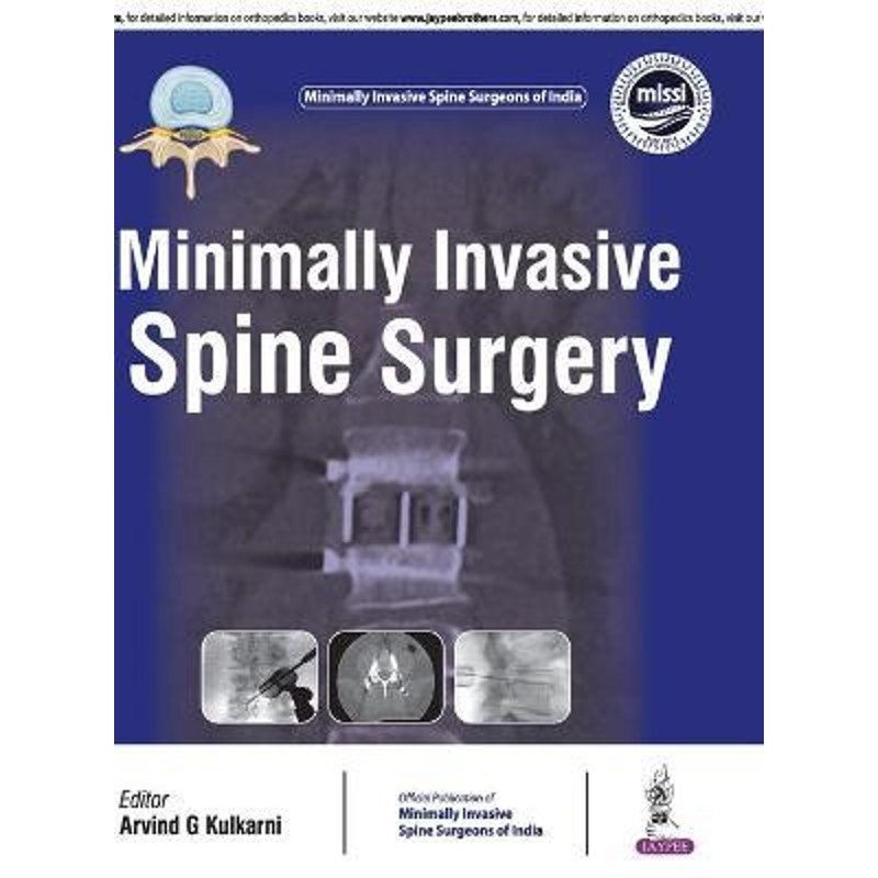 预订，预计下单后2-3周左右发货！