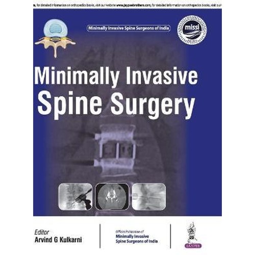 预订，预计下单后2-3周左右发货！