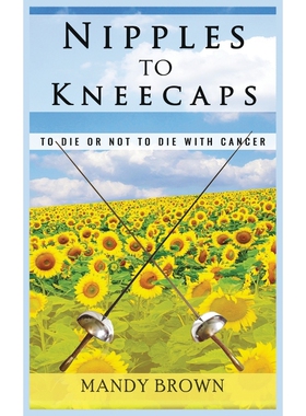 按需印刷不退不换Nipples To Kneecaps[9781999907600]