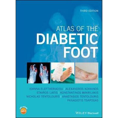 按需印刷不退不换Atlas of the Diabetic Foot[9781119255239]