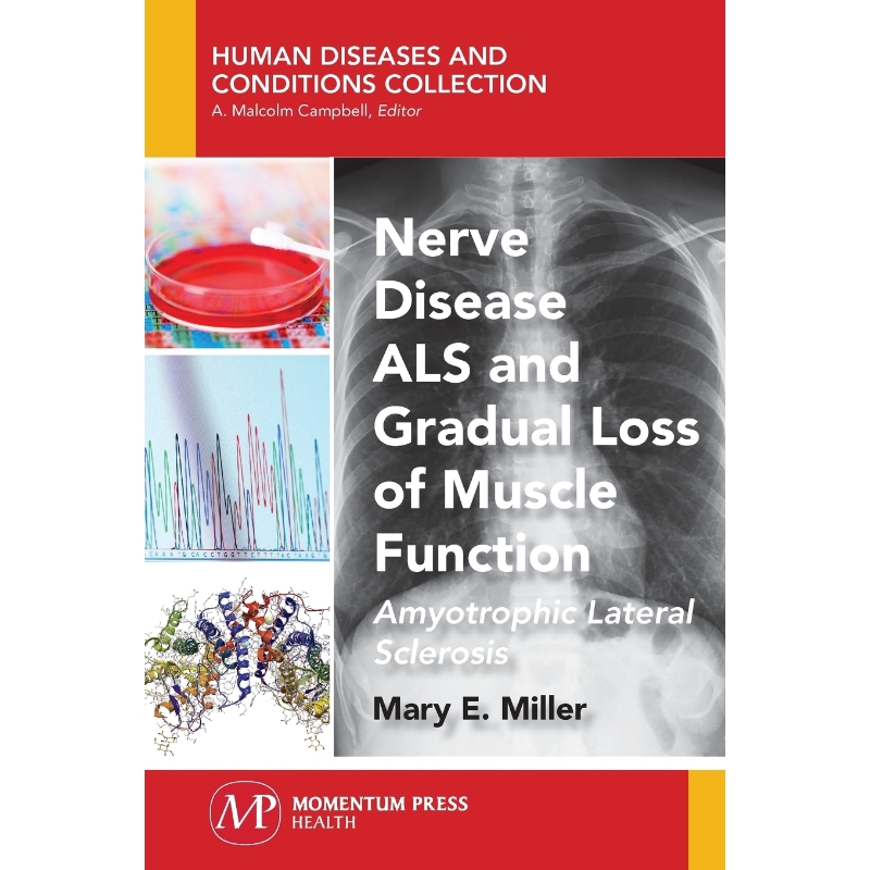按需印刷Nerve Disease ALS and Gradual Loss of Muscle Function[9781944749798]