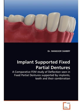 按需印刷Implant Supported Fixed Partial Dentures[9783639356496]